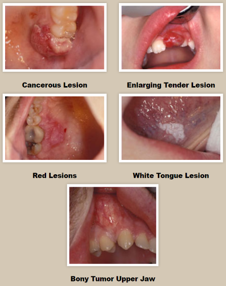 oral pathology images