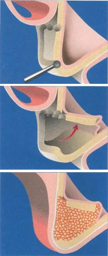 sinus diagram
